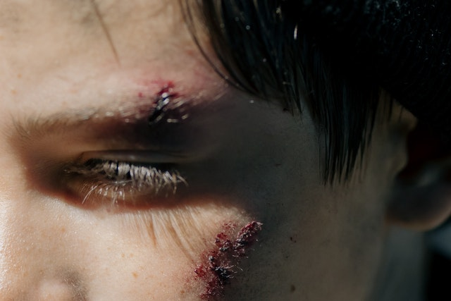 Closeup of an injured face